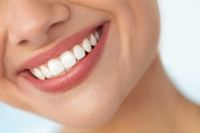 woman with attractive smile