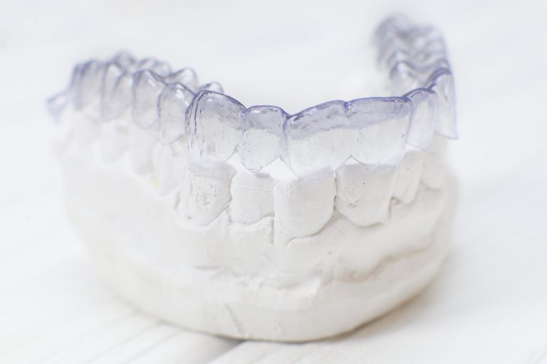 Invisalign aligner on dental mold